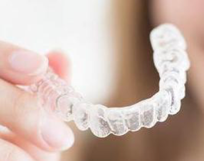 Removable clear aligner