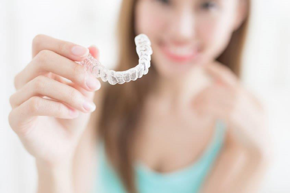 Clear aligner treatment illustration